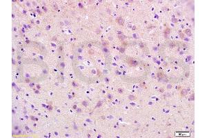 Formalin-fixed and paraffin embedded mouse brain tissue labeled with Anti-RAP1A Polyclonal Antibody, Unconjugated (ABIN687472) at 1:200 followed by conjugation to the secondary antibody, (SP-0023), and DAB staining (RAP1A 抗体  (AA 101-184))