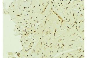Immunohistochemistry (IHC) image for anti-MutS Homolog 6 (E. Coli) (MSH6) (Internal Region) antibody (ABIN6263386)