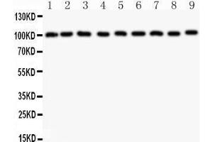Western Blotting (WB) image for anti-Cas-Br-M (Murine) Ecotropic Retroviral Transforming Sequence (CBL) (AA 556-906) antibody (ABIN3043746) (CBL 抗体  (AA 556-906))