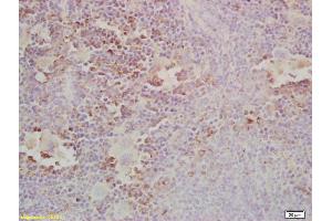 Formalin-fixed and paraffin embedded mouse spleen labeled with Anti-Gab2 Polyclonal Antibody, Unconjugated (ABIN681178) at 1:200, followed by conjugation to the secondary antibody and DAB staining (GAB2 抗体  (AA 601-676))