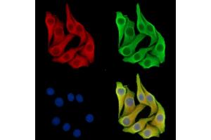 ABIN7097156 and ABIN7101224 staining Hela cells by IF/ICC. (CPQ 抗体)