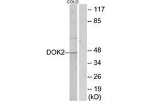 Western blot analysis of extracts from COLO205, using p56 Dok-2 (Ab-299) Antibody. (DOK2 抗体  (AA 266-315))
