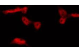 ABIN6267489 staining HepG2 by IF/ICC. (Aryl Hydrocarbon Receptor 抗体  (pSer36))