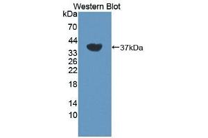Detection of Recombinant DYRK1A, Human using Polyclonal Antibody to Dual Specificity Tyrosine Phosphorylation Regulated Kinase 1A (DYRK1A) (DYRK1A 抗体  (AA 16-300))