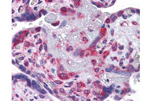 Immunohistochemistry (IHC) image for anti-Y Box Binding Protein 1 (YBX1) (Middle Region) antibody (ABIN2775773) (YBX1 抗体  (Middle Region))