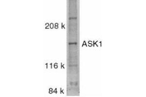 Western blot analysis of ASK1 in SW1353 whole cell lysate with AP30085PU-N ASK1 antibody at 1/500 dilution.