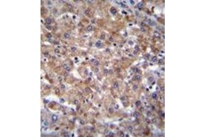 Immunohistochemistry (Paraffin-embedded Sections) (IHC (p)) image for anti-Pleckstrin Homology Domain Containing, Family A (phosphoinositide Binding Specific) Member 4 (PLEKHA4) (AA 28-58), (N-Term) antibody (ABIN954197)