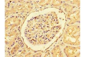 Immunohistochemistry of paraffin-embedded human kidney tissue using ABIN7151461 at dilution of 1:100 (EHD3 抗体  (AA 269-498))