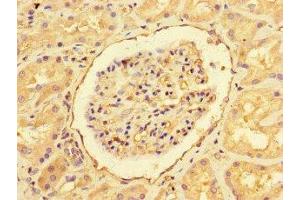 Immunohistochemistry of paraffin-embedded human kidney tissue using ABIN7151461 at dilution of 1:100 (EHD3 抗体  (AA 269-498))