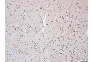 Formalin-fixed and paraffin embedded rat brain labeled with Anti-Myelin Protein Zero Polyclonal Antibody, Unconjugated  at 1:200 followed by conjugation to the secondary antibody and DAB staining (MPZ 抗体  (AA 175-248))