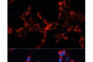 Immunofluorescence analysis of NIH/3T3 cells using CTSL Polyclonal Antibody at dilution of 1:100. (Cathepsin L 抗体)