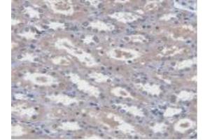 Detection of UBE2L3 in Human Kidney Tissue using Polyclonal Antibody to Ubiquitin Conjugating Enzyme E2L3 (UBE2L3) (UBE2L3 抗体  (AA 4-154))