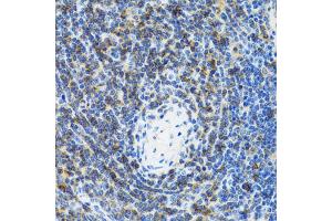 Immunohistochemistry of paraffin-embedded rat spleen using SRP19 antibody (ABIN2560139) at dilution of 1:100 (40x lens). (SRP19 抗体)