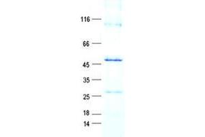 Western Blotting (WB) image for Receptor (Chemosensory) Transporter Protein 4 (RTP4) protein (GST tag,His tag) (ABIN5505757)