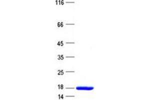 Validation with Western Blot (NHSL2 Protein (His tag))