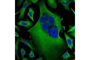Immunofluorescent analysis of Beta-tubulin staining in Hela cells. (TUBB 抗体)