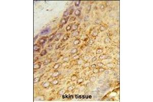 Formalin-fixed and paraffin-embedded human skin tissue reacted with LDHA Antibody (Center), which was peroxidase-conjugated to the secondary antibody, followed by DAB staining. (Lactate Dehydrogenase A 抗体  (AA 154-182))