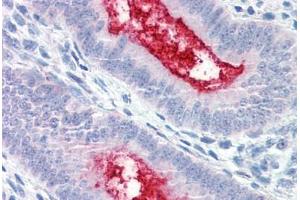 Anti-ENPP3 antibody  ABIN1048561 IHC staining of human uterus. (ENPP3 抗体  (Internal Region))
