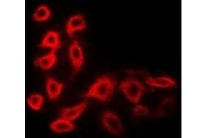 Immunofluorescence (IF) image for anti-Cytochrome P450, Family 51, Subfamily A, Polypeptide 1 (CYP51A1) antibody (ABIN7307716)