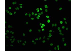 Immunofluorescence staining of HepG2 cells with ABIN7139585 at 1:2. (Histone H1-Like (LOC107807853) (meLys101) 抗体)