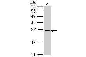 WB Image Sample (30 ug of whole cell lysate) A: A431 , 12% SDS PAGE antibody diluted at 1:5000 (RRAS2 抗体  (Center))