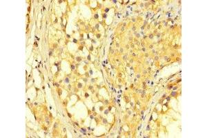 Immunohistochemistry of paraffin-embedded human testis tissue using ABIN7150987 at dilution of 1:100