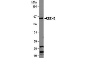 Western blot analysis of EZH2 in Jurkat whole cell lysate using EZH2 polyclonal antibody . (EZH2 抗体  (AA 300-400))