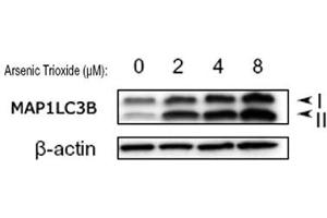 Western blot analysis of MAP1LC3B in treated U87 MG (human glioblastoma astrocytoma) lysates using MAP1LC3B polyclonal antibody . (LC3B 抗体  (AA 1-50))