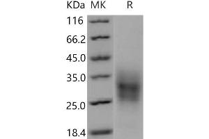 Western Blotting (WB) image for Tumor Necrosis Factor Receptor Superfamily, Member 10b (TNFRSF10B) (Active) protein (His tag) (ABIN7198413)