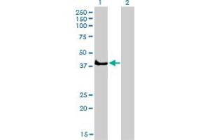 Western Blot analysis of SGK2 expression in transfected 293T cell line by SGK2 monoclonal antibody (M04A), clone 4B12. (SGK2 抗体  (AA 293-367))
