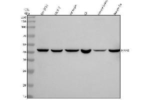 Western blot analysis of HRH3 using anti-HRH3 antibody (ABIN7605164).
