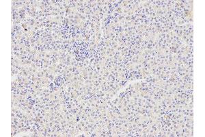 Immunohistochemistry of paraffin-embedded mouse kidney using FAS antibody at dilution of 1:400 (200x lens). (FAS 抗体)