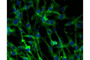 Immunofluorescent staining of C6 cells (right). (Clathrin 抗体  (AA 4-171))