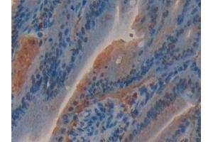 Immunohistochemistry (IHC) image for anti-Glutathione S-Transferase omega 1 (GSTO1) (AA 24-233) antibody (ABIN7432229)
