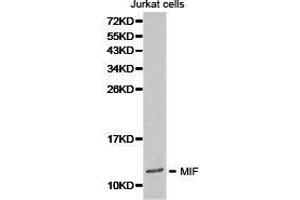 Western Blotting (WB) image for anti-Macrophage Migration Inhibitory Factor (Glycosylation-Inhibiting Factor) (MIF) antibody (ABIN1873693) (MIF 抗体)