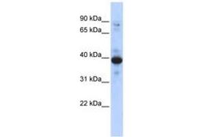 Image no. 1 for anti-Ring Finger Protein 34 (RNF34) (AA 143-192) antibody (ABIN6742950) (RNF34 抗体  (AA 143-192))