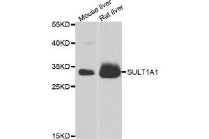 Western blot analysis of extracts of various cell lines, using SULT1A1 antibody (ABIN5970776) at 1/1000 dilution. (SULT1A1 抗体)