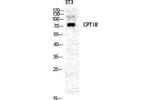 Western Blot (WB) analysis of NIH-3T3 cells using CPTI-M Polyclonal Antibody. (CPT1B 抗体  (Internal Region))