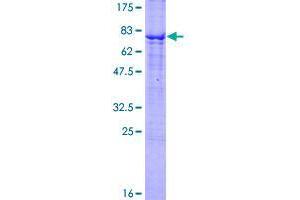 Image no. 1 for Tumor Necrosis Factor Receptor Superfamily, Member 19 (TNFRSF19) (AA 1-417) protein (GST tag) (ABIN1323172)