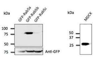 Anti-Rab5b Ab at 1/500 dilution; 293 cells transfected with GFP-Rab5; Iysates at 50 µg per Iane; rabbit polyclonal to goat IgG (HRP) at 1/10,000 dilution; (RAB5B 抗体  (C-Term))