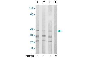 Western blot analysis of extracts from 293 cells (Lane 1), HepG2 cells (Lane 2) and COLO 205 cells (Lane 3 and 4), using GSC2 polyclonal antibody . (GSC2 抗体)