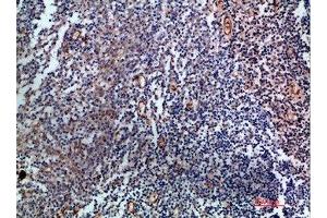 Immunohistochemical analysis of paraffin-embedded human-tonsil, antibody was diluted at 1:200 (Endoglin 抗体  (AA 370-430))