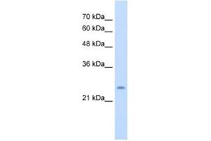 CHIC1 antibody used at 5 ug/ml to detect target protein. (CHIC1 抗体  (N-Term))