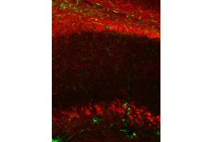 Immunohistochemistry (IHC) image for anti-Claudin 11 (CLDN11) (AA 188-207) antibody (ABIN1742489) (Claudin 11 抗体  (AA 188-207))