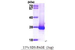 DIRAS Family, GTP-Binding RAS-Like 1 (DIRAS1) (AA 1-195) protein (His tag)