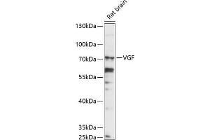 Western blot analysis of extracts of rat brain, using VGF antibody (ABIN7271321) at 1:1000 dilution. (VGF 抗体  (AA 466-615))