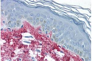 Human Skin (formalin-fixed, paraffin-embedded) stained with Collagen I antibody ABIN291823 at 2. (Collagen Type I 抗体)
