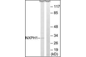 Western blot analysis of extracts from rat heart cells, using NXPH1 Antibody . (Neurexophilin 1 抗体  (C-Term))