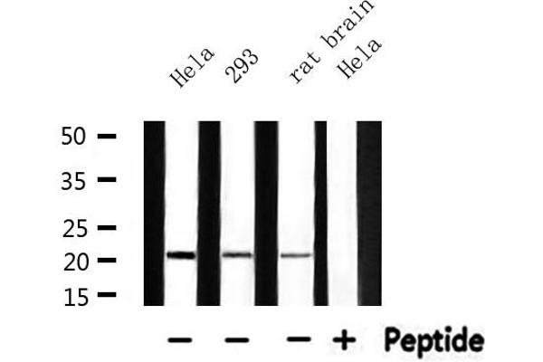 MRPL11 抗体  (Internal Region)