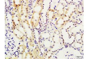 Formalin-fixed and paraffin embedded rat kidney tissue labeled with Anti-Smad7/Smad6 Polyclonal Antibody , Unconjugated at 1:200, followed by conjugation to the secondary antibody and DAB staining (SMAD7 抗体  (AA 1-100))